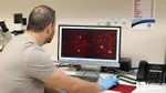 Türk bilim insanlarından Alzheimer hastalığını erken evrede yakalayacak çalışma!